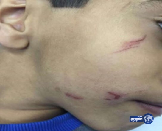 ولي أمر يتهم معلماً يصفع ابنه على وجهه