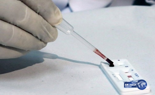 اكتشاف أول حالة إصابة بفيروس زيكا في التشيك