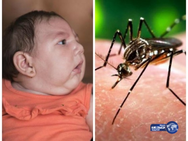 الصحة العالمية: الشرق الأوسط نجح في القضاء على زيكا