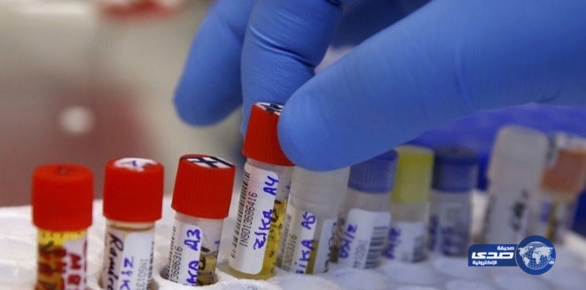 ماليزيا تسجل أول إصابة محلية بفيروس «زيكا»