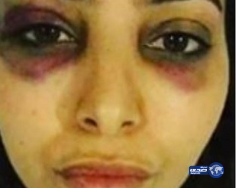 بالفيديو.. فاطمة الصفي :هذه حقيقة تعرضي للضرب