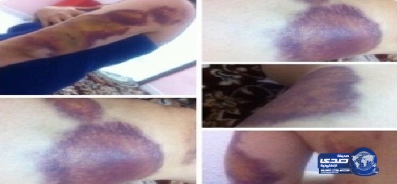 الشؤون الاجتماعية بـمكة : توصلنا للفتاة نورة وهي الآن تحت الحماية