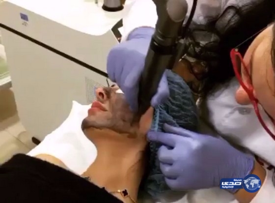 بالفيديو : عملية تجميل “مريم حسين “تصيب الفتيات بالهلع