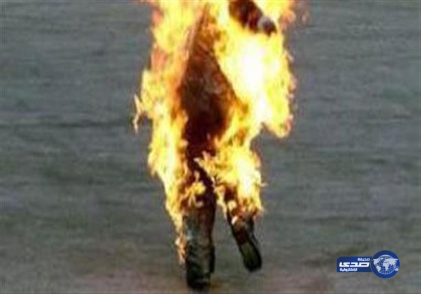 عريس يحرق عروسه في باكستان بسبب عدم التزامها بـ”المهر” المتفق عليه