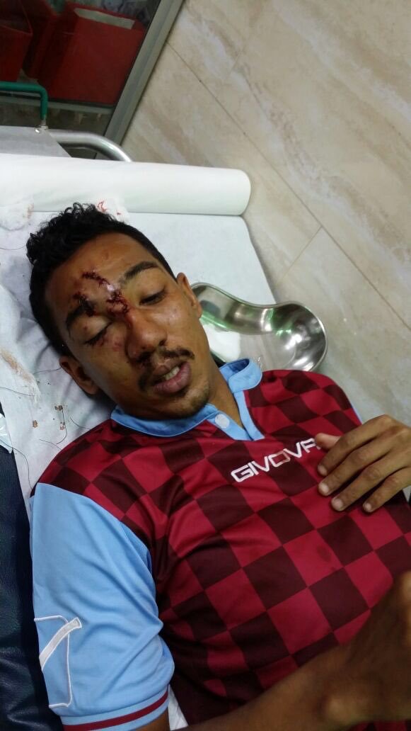 رئيس الدرعية : ماركينيوس كاد أن يفقأ عين اللاعب