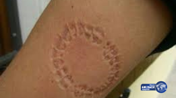 السجن لشاب بحريني “عض” شرطيا للتملص من مخالفة مرورية