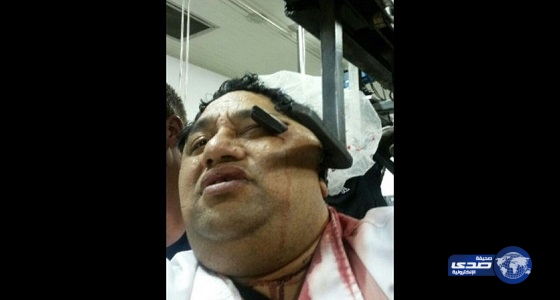 ماكينة تقطيع لحوم تبقى نيوزيلنديا عالقاً لساعة