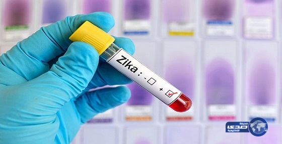 وفاة أول حالة “أمريكية” بفيروس”زيكا”