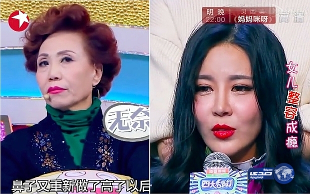 بالصور.. أم تتبرأ من ابنتها بسبب إدمانها عمليات التجميل