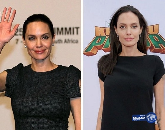 حالة صحية حرجة تمر بها “أنجلينا”