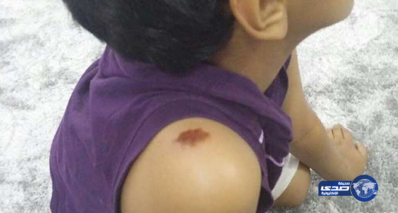 طفل ينجو من هجوم كلاب ضالة بـ”عفيف”