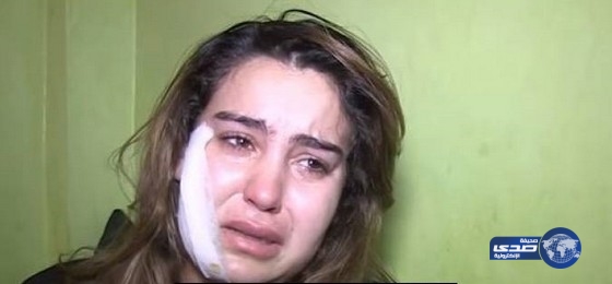 فيديو.. زوج يشوه وجه زوجته بسبب خيانتها