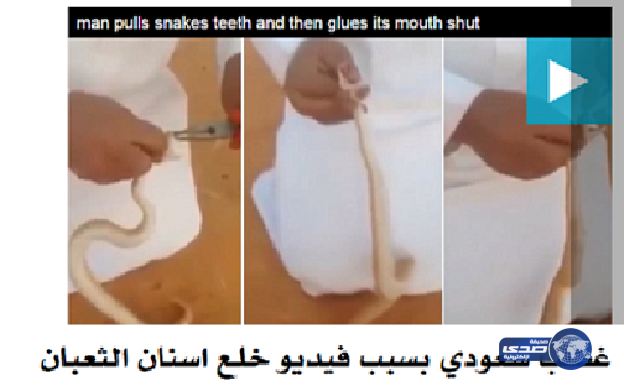 &#8220;الديلي ميل&#8221;  تنشر مقطع خلع أسنان الثعبان .. وتعلق السعوديين غاضبون