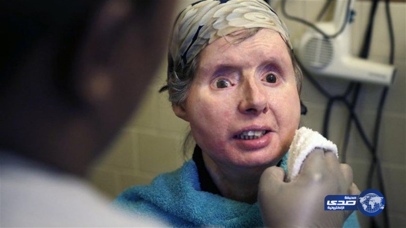 وجه ميتة على اخرى حية!