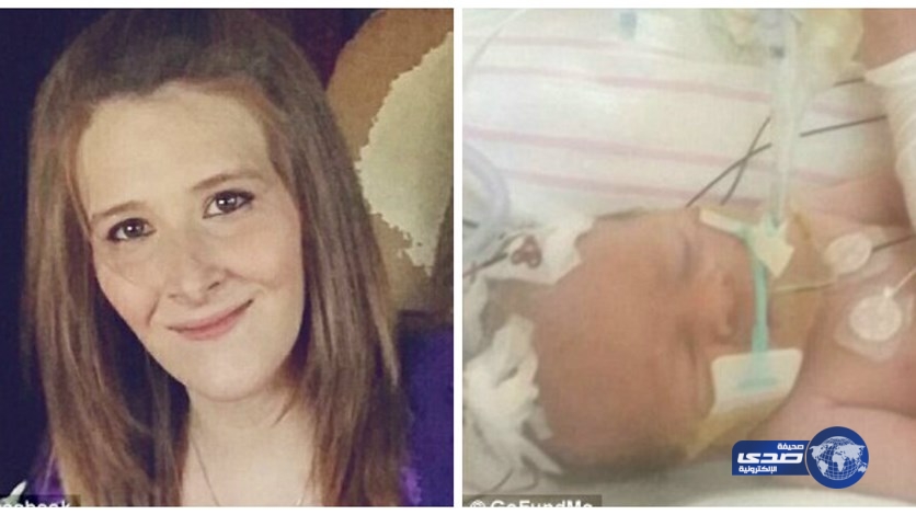 أنجبت طفلتها بعد وفاتها بلحظات