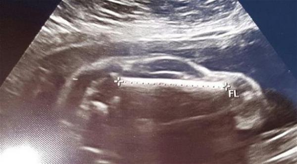 هل هذه المرأة حامل بسيارة رياضية؟