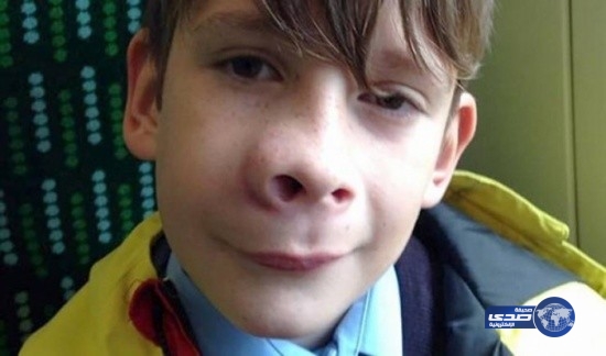 ظنت أمه أن ناموسة قرصته.. لن تصدّق ماذا اكتشفت بأنفه!