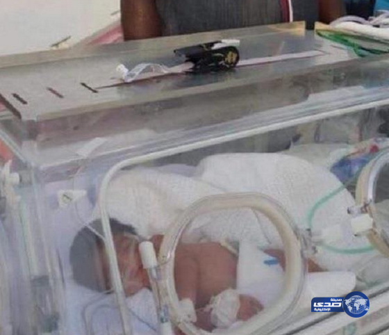 صحة جازان تبرر واقعة “نقل مولودة فرسان بالفالوكة” (صور)