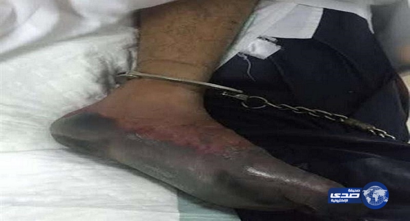 وفاة السجين المصاب بالـ”غرغرينا” وأسرته ترفض استلام جثمانه