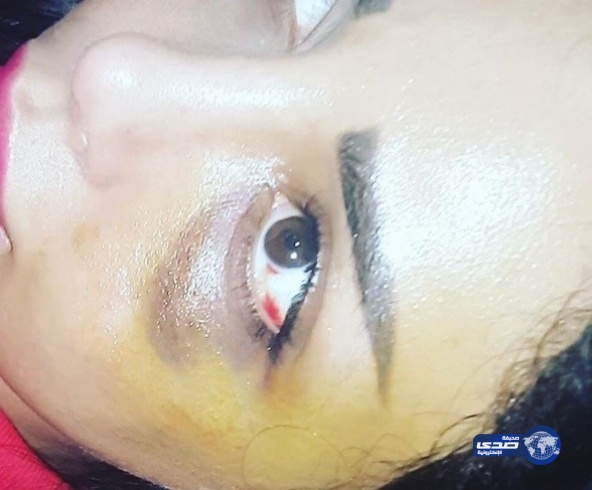 شقيقة هيفاء وهبي: هذه آثار ضربي ومحاولة قتلي عمداً