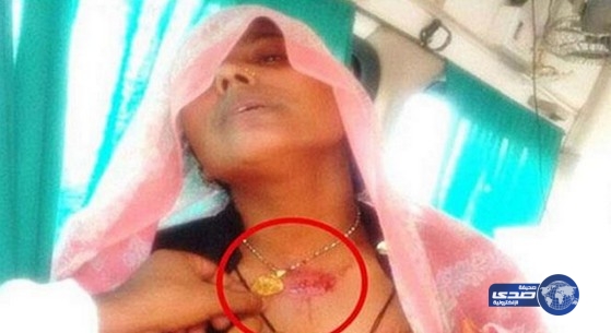 «قلادة» تُنجي شابة هندية حاول شقيقها قتلها !