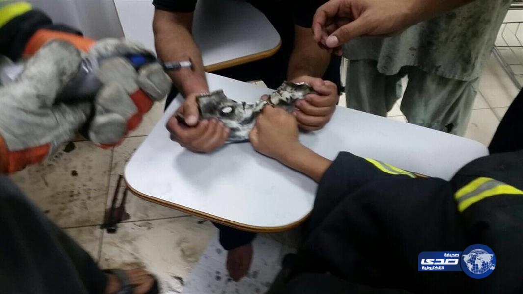 بالصور.. الدفاع المدني يحرر إصبع طفل من “جنط” سيارة