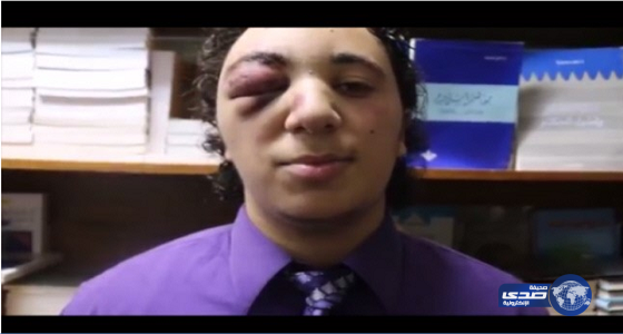 بالفيديو.. بسبب تواجده أمام مسجد تعرض لهذا الاعتداء