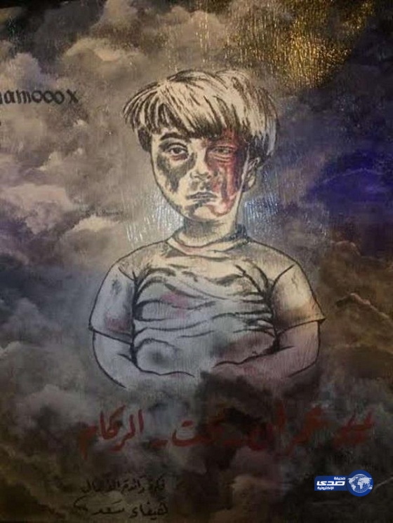 بالصور ..لوحة تجسد مأساة الطفل السوري&#8221;عمران&#8221;في شارع الفن بأبها