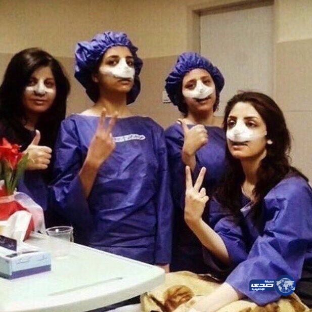 البنات وعمليات تجميل الانف..