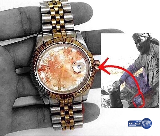 بالصور ..آثار الدماء على ساعة الشهيد &#8220;علي نتيفات&#8221;.. ومغردون: لا تنسوه من الدعاء