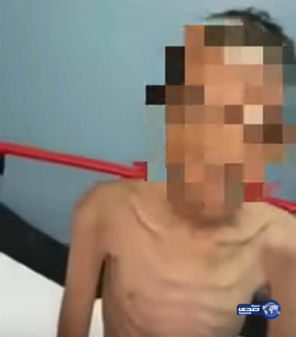 بالفيديو.. عم “معنفي خيبر”: الطفل يعاني من هذيان  وحالة بدنية سيئة ..والام لاتزال طليقة
