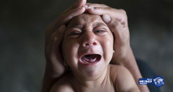 إصابة 49 حامل ب ” زيكا” وولادة طفل مشوه فى أمريكا