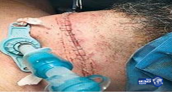 مستشفى أحد بالمدينة ينقذ كويتيًا حاول قطع رقبته بآلة حادة