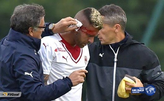 بالصور: ليس لضعاف القلوب.. النجم الفرنسي يفقد أذنه في تدخل عنيف للغاية