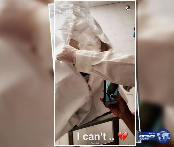 طالبة طب تحذف مقاطع فيديو نشرتها لجثامين موتى بعد حملة انتقادات