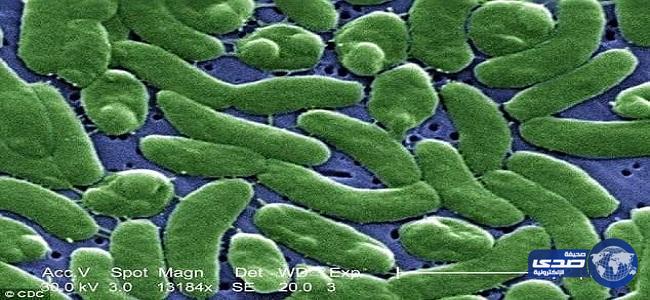  ⁠⁠⁠بالصور .. بكتيريا تلتهم أمريكي خلال 3 أيام و السبب غريب!!