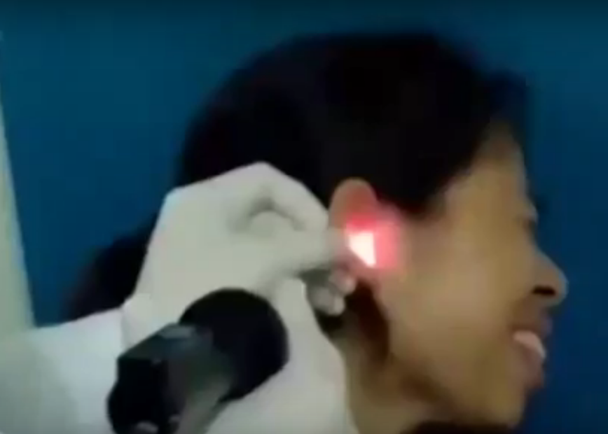 بالفيديو.. أطباء يستخرجون صرصارًا من أذن امرأة تسرب إليها عند نومها