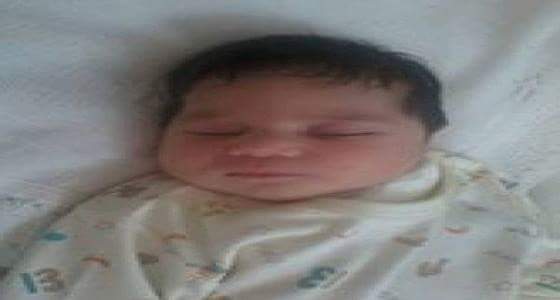 بالصور..طبيب فلسطيني ينجح في إعادة وجه طفلة ولدت بورم إلى صورته