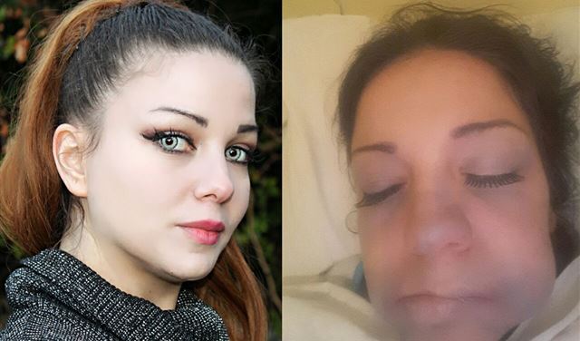 بالصور..فنانة لبنانية تتوعد طبيب بسبب عملية تجميل شوهت وجهها