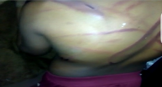 فرع العمل بتبوك يوجه وحدة الحماية الأسرية بمباشرة بلاغ تعذيب يتيم