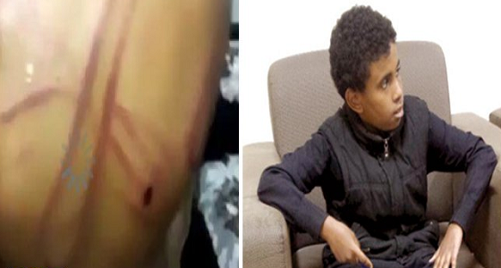 تفاصيل جديدة عن تعذيب طفل &#8221; تبوك &#8220;.. عمه عنفه بسلك واعتاد الاعتداء عليه وشقيقه بالضرب
