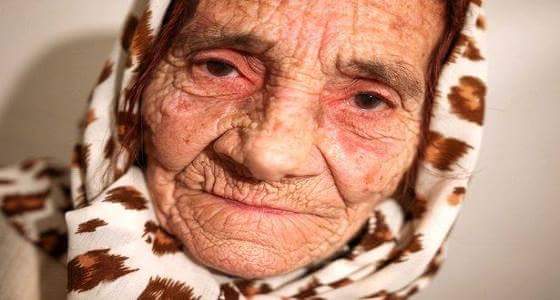 بالصور..عجوز تستخدم لسانها لعلاج مرضاها من العمى
