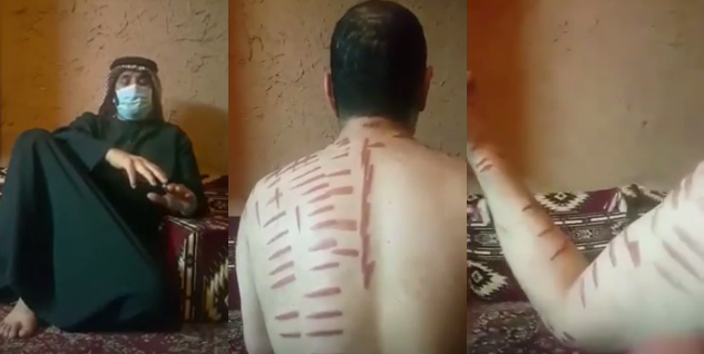 بالفيديو.. مواطن يروي معاناته مع العلاج بالكي في القصيم