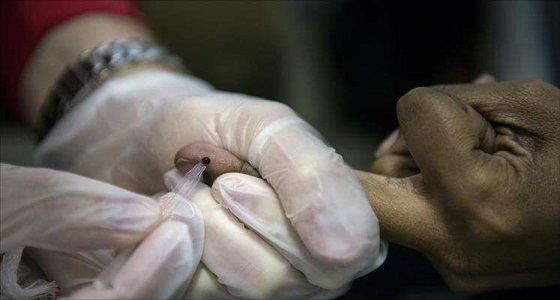 7000 مواطن أصيبوا بـ « الإيدز » خلال 30 عاماً