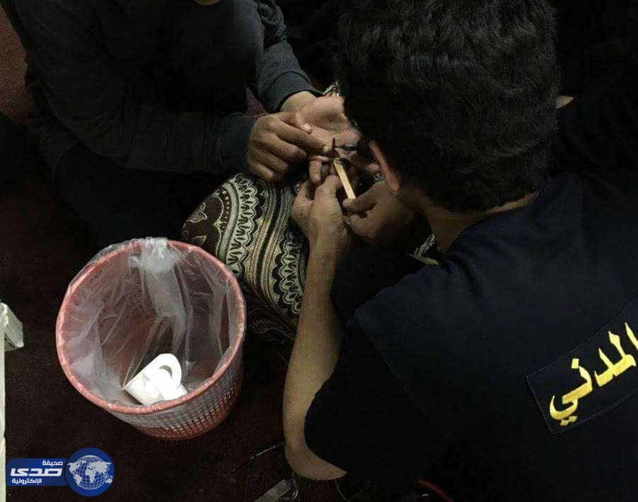 مدني رفحاء يحرر أصبع شاب من خاتم حديدي