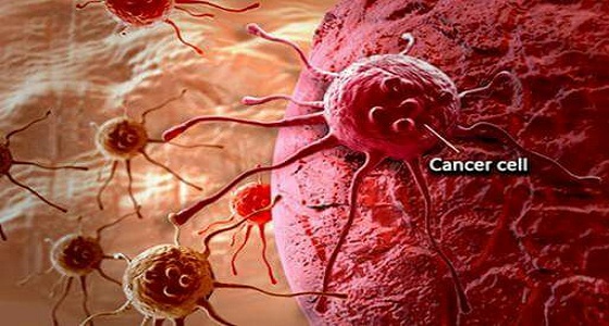 المملكة تسجل  14 ألف حالة سرطانية خلال سنة واحدة