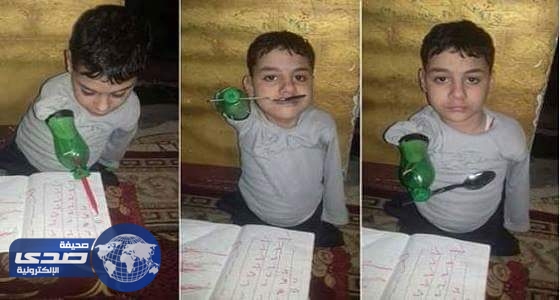 بالفيديو..طفل مصري يستعمل قارورة بلاستيكية كطرف صناعي