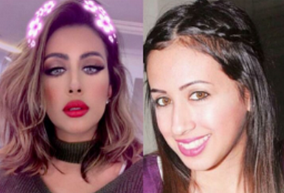 فرح الهادي قبل وبعد التجميل..