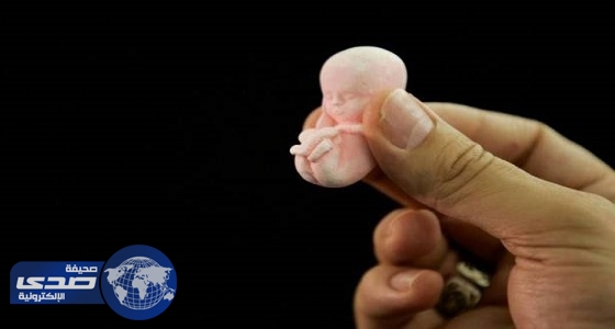 ” بلد عربي ” الأول عربياً في عمليات الاجهاض والثامن عالمياً