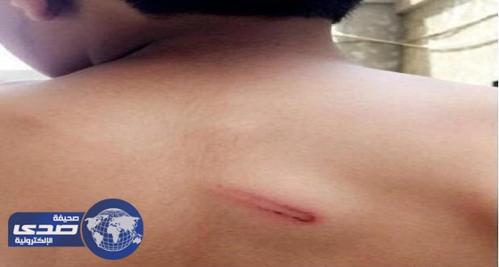 بالفيديو.. مفاجأت تكشفها التحقيقات في واقعة اعتداء معلم على طالب ابتدائي بجازان